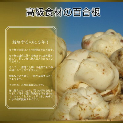 【ふるさと納税】2026年秋発送開始【訳あり】北海道富良野産 ゆり根 2kg【1485400】 - 画像2