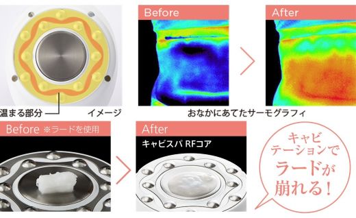 【ふるさと納税】 美容家電 ヤーマン 美容器 ボディケア YA-MAN ｜ キャビテーション フェイスケア 超音波 EMS ラジオ波 RF 家庭用 防水 お風呂 エステ プレゼント ギフト キャビスパRFコアPLUS HRF51B 宮城県 加美町 sl00003 - 画像2