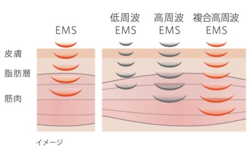 【ふるさと納税】 美容家電 ヤーマン 美容器 ボディケア YA-MAN ｜ キャビテーション フェイスケア 超音波 EMS ラジオ波 RF 家庭用 防水 お風呂 エステ プレゼント ギフト キャビスパRFコアPLUS HRF51B 宮城県 加美町 sl00003 - 画像3
