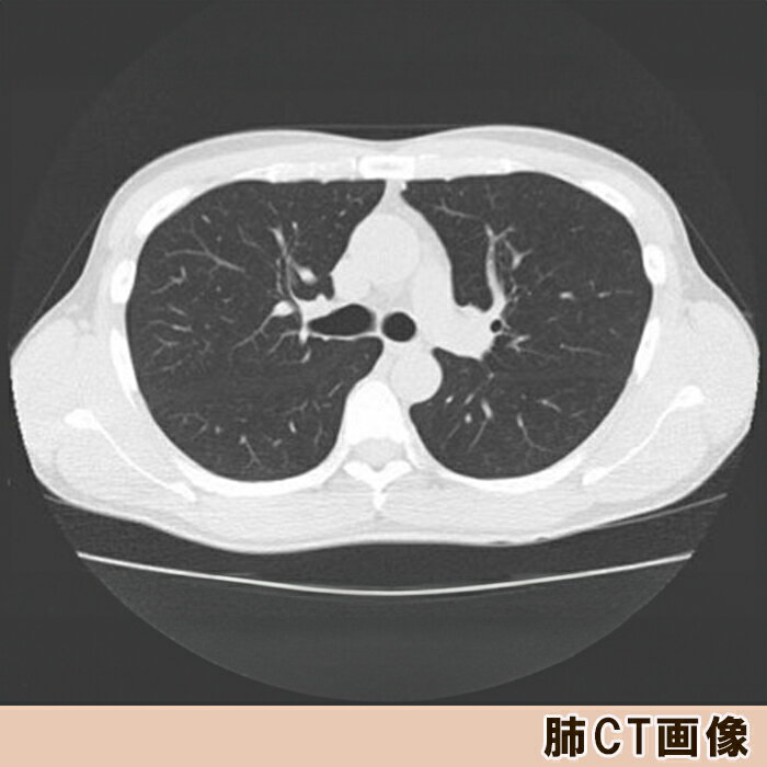 【ふるさと納税】【亀田クリニック人間ドック】肺CT検査（肺がん検診）コース　1名様（単独）　[0055-0002] - 画像2