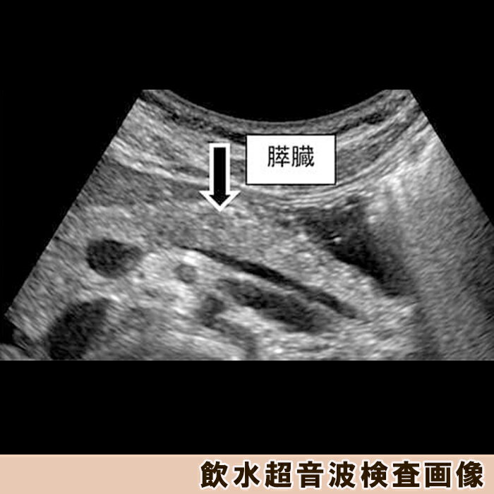 【ふるさと納税】【亀田クリニック人間ドック】アドバンスト2（膵臓）コース　1名様（1泊2日）　[0670-0002] - 画像3