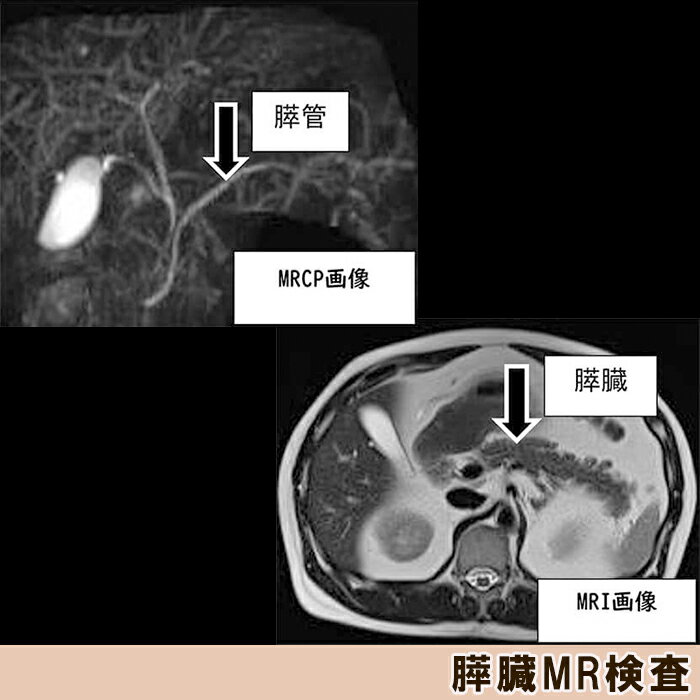 【ふるさと納税】【亀田クリニック人間ドック】アドバンスト2（膵臓）コース　1名様（1泊2日）　[0670-0002] - 画像2